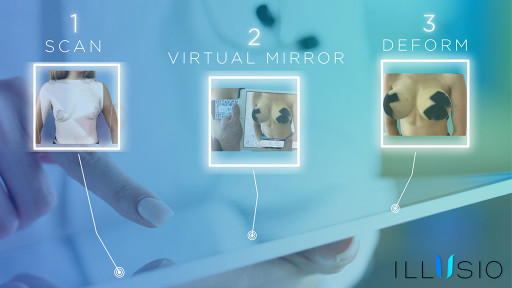 Augmented Reality Virtual Mirror is Revolutionizing Plastic Surgeon Consultations for the Future