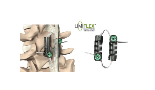 FDA Grants PMA Approval to LimiFlex(TM) Dynamic Sagittal Tether