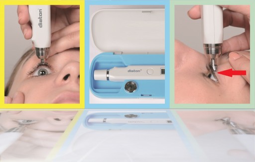 Unique Tonometer, Diaton, Helps to Meet and Exceed Joint Commission Guideline for Disinfection and Sterilization