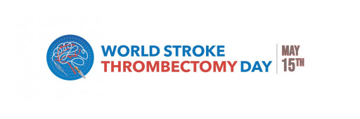 Thrombectomy Stroke Treatment Reversing Paralysis and Preventing Death Gets Its Global Day