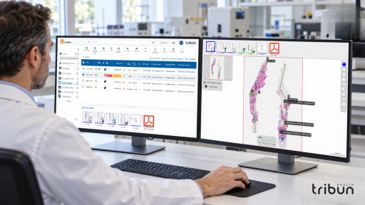 Tribun Health Expands into Australia as CaloPix(R) 6.2.0 Is Included in the ARTG