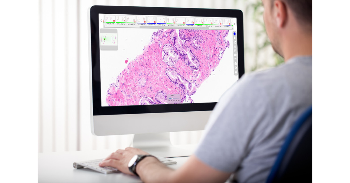 Tribun Health Announces CaloPix(R) 6, Its First IVDR-Certified Version ...