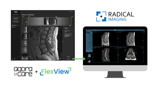Radical Imaging Announces Integration of FlexView Inside Agora Care