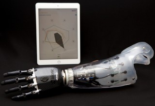 Myo Plus Pattern Recognition System with bebionic hand - by Ottobock
