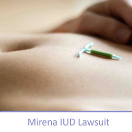Mirena IUD Lawsuits Move Forward as Federal Court Readies to Convene...