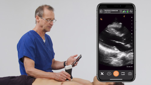 Clarius Announces New Education Program to Help More Emergency Physicians Use Ultrasound for Faster, More Accurate Diagnoses