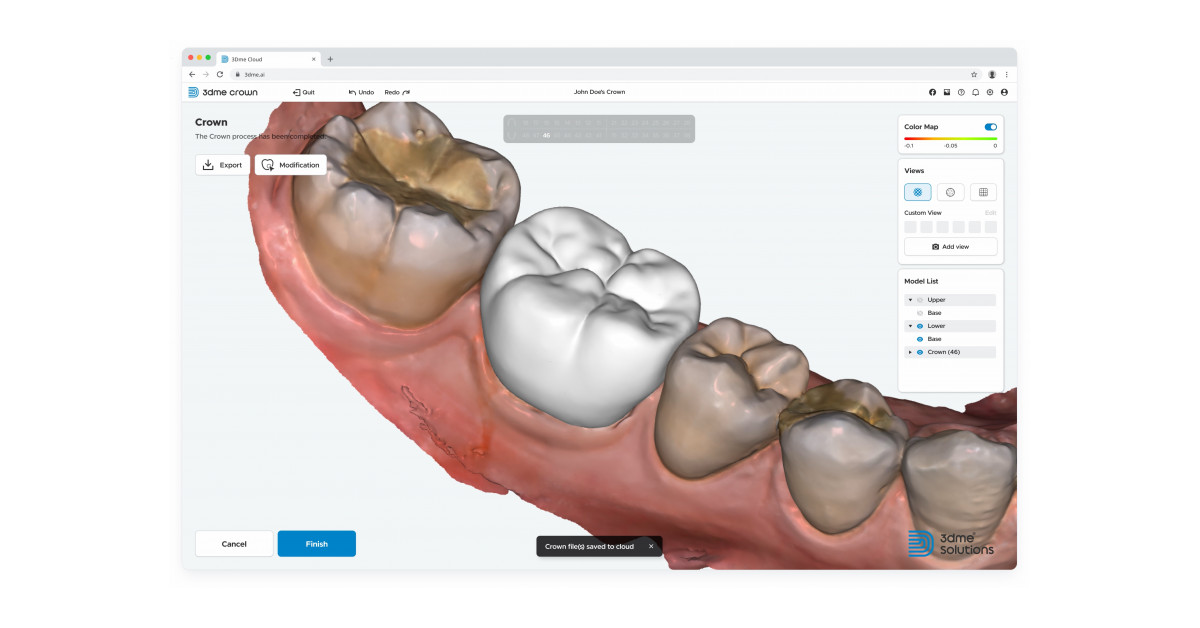 Imagoworks Launches AI-Based Web Dental CAD 3Dme Crown | Newswire