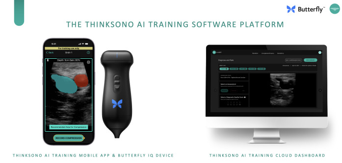 ThinkSono AI Training Platform