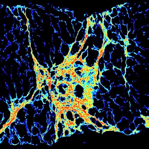 PharmaNest Launches FibroNest, the First Multivendor Image Analysis and Translational Platform for the Assessment of the Severity and Progression of Fibrosis in NASH