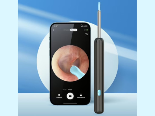 Earopro Cleaner Recognized as 2025's Leading At-Home Earwax Removal Device Featuring HD Camera & App-Controlled Precision
