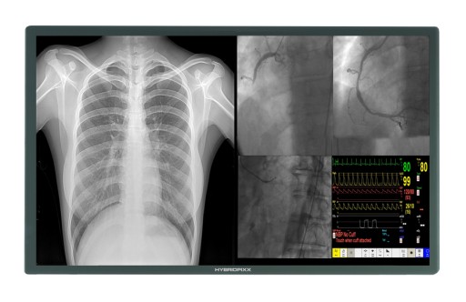 AMPRONIX'S Medical 4k Technology Is Cutting-Edge: Our Surgical Displays and Medical Imaging Solutions Are Life Changing