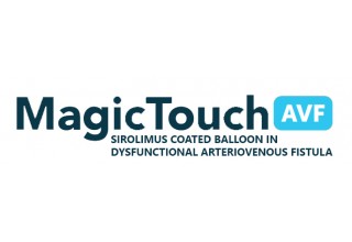 MagicTouch AVF