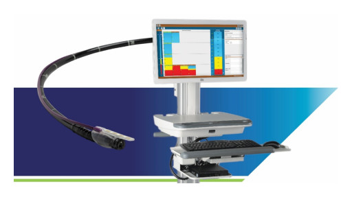MiVu Mucosal Integrity Testing System Marks 25,000 Procedures Performed