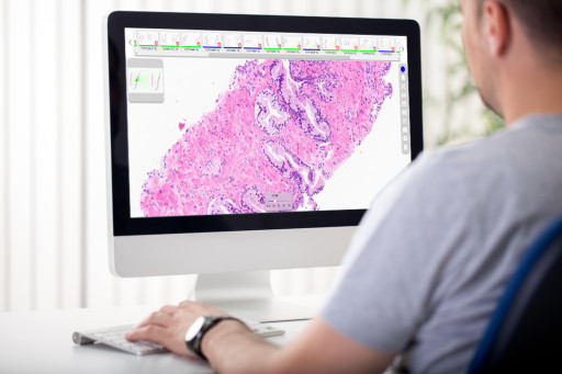 Tribun Health Announces CaloPix(R) 6, Its First IVDR-Certified Version for Routine Diagnostic Use