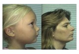 A similar appearance, but mom wants better for her little girl.