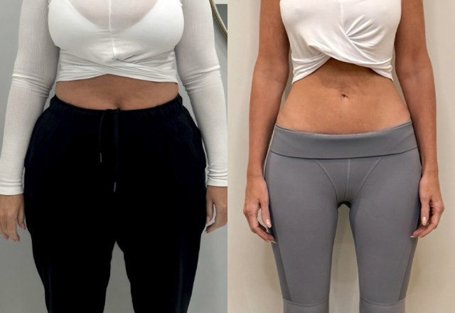 BODYWELLE brings established experience with physician-supervised GLP-1 therapy, with over 127 satisfied patients.