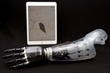 Myo Plus Pattern Recognition System with bebionic hand - by Ottobock