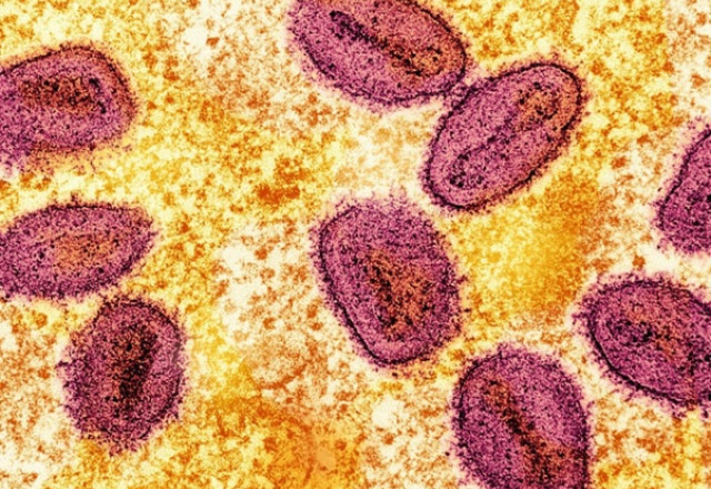 Mpox Virus