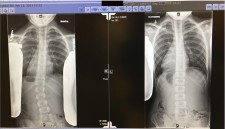 X-ray results