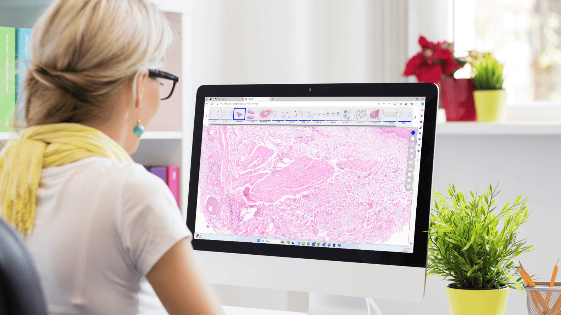 Pathologist Using CaloPix® for Digital Slide Review