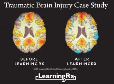 Brain Injury Research with LearningRx Brain Training