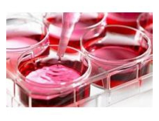 Cell Culture Market Demand by 2025: QY Research
