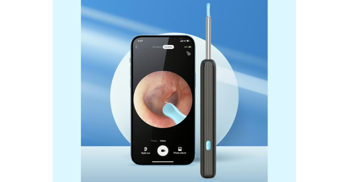Earopro Cleaner Recognized as 2025’s Leading At-Home Earwax Removal Device Featuring HD Camera & App-Controlled Precision