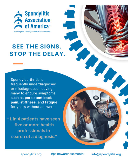 Spondylitis Association of America Launches "See the Signs. Stop the Delay."  National Awareness Campaign to Reduce Misdiagnosis and Delays in Spondyloarthritis Care