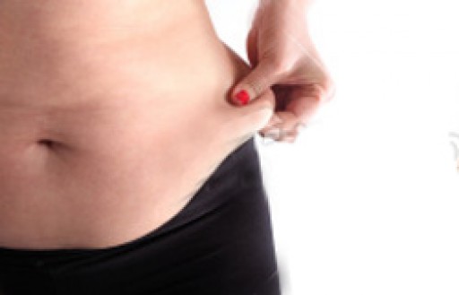 Dr William Frazier Discusses What Happens to the Belly Button During a Tummy Tuck