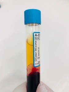 Acellular-Convalescent Plasma (A-CP) tube by Regen Lab