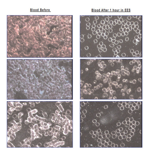 Four-Week Hawaii Project Uses Dark-Field Live Blood Microscopy To Explore Pre/Post Patterns During Energy Enhancement System™ (EES) Exposure