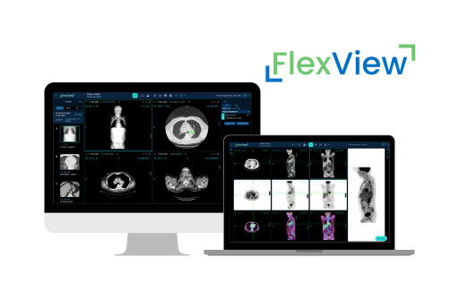 Radical Imaging Launches FlexView