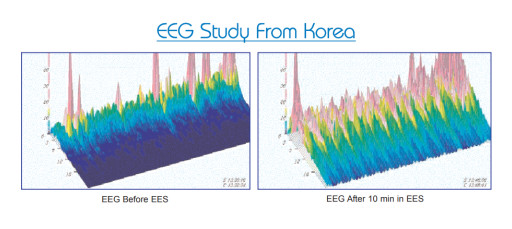 Korea EEG Comparison Highlights Measurable Brain-Activity Shifts After 10 Minutes In EES, Sparking Calls For Controlled Replication