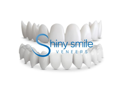 Shiny Smile Veneers Review 2025: Affordable Dentist-Designed Snap-on Veneers for a Natural At-Home Smile Transformation