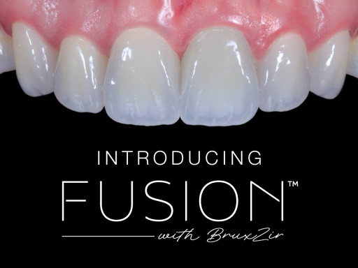 Glidewell Launches Fusion With BruxZir(TM) Zirconia