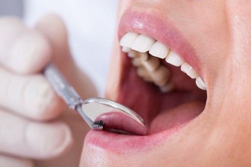 Advice From the Sacramento Dentistry Group on Avoiding Oral Cancer