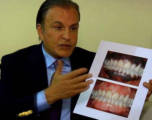 Dr. Alex Farnoosh, Cosmetic Dentist & Periodontist in Beverly Hills Introduces a Novel Technique