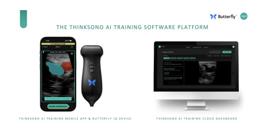 ThinkSono Releases Real-Time DVT AI Training Solution for Butterfly Network’s Handheld Ultrasound Devices