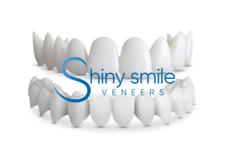 Shiny Smile Veneers Reviews 2025