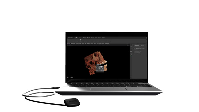 DEXIS launches DEXIS Connect Pro, a new proactive service platform for DEXIS CBCT and intraoral sensor devices focused on increasing device availability