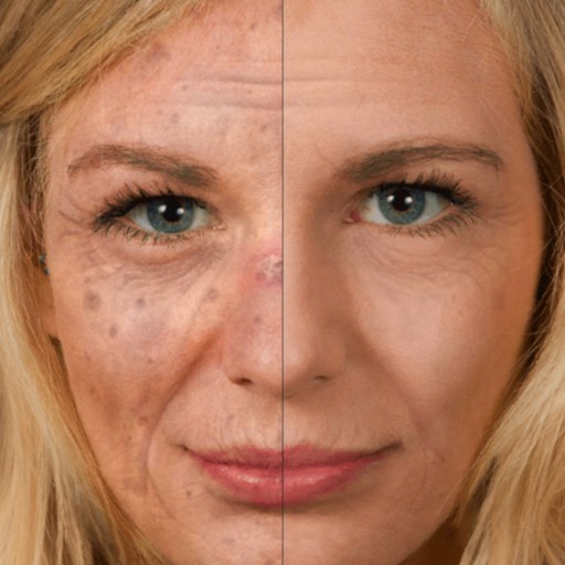 New Selfie-App Helps to Prevent Skin Cancer