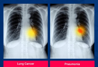 HOW CAN IMAGE ANALYTICS AI HELP THE RADIOLOGISTS FOR BETTER CLINICAL DECISION SUPPORT?