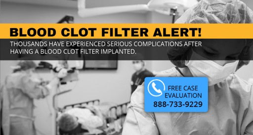 How to Join the IVC Filter Litigation at No Cost to You or Your Family