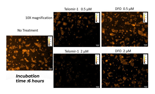Telomir Pharmaceuticals Reports Telomir-1 Outperforms FDA-Approved Gold-Standard Iron Chelator Deferoxamine (DFO) in Reducing Intracellular Iron in a Human Cell Line