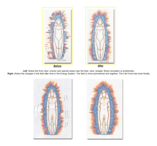 GDV Bio-Electrography Before-And-After Results Spotlight A Measurement Path For EESystem™ Research