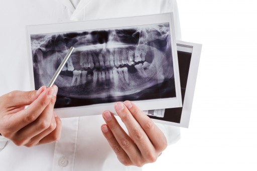 The Sacramento Dentistry Group Discusses Dental X-Rays