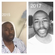 Before and After Cancer