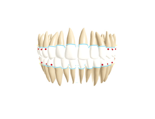 Alta AI Debuts New 3D Perio Index Tool That Drives SRP Acceptance
