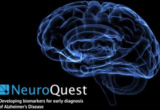NeuroQuest developing biomarkers for early diagnosis of Alzheimer's disease