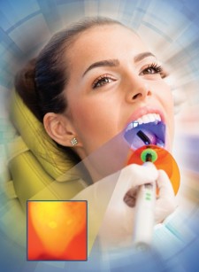 Illuminated Dental Cavities